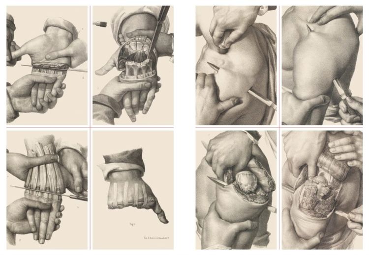 手术剧场:重现19世纪外科的医疗绘画
